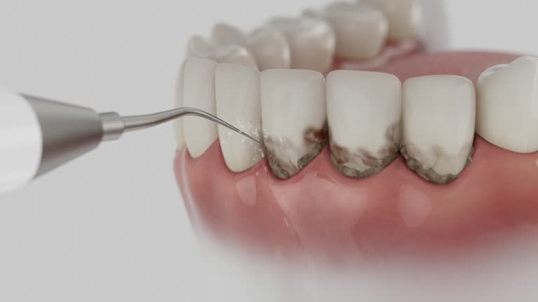 Reliable Emergency Dentist contractor in Randolph, NE by Smile Center Dentistry